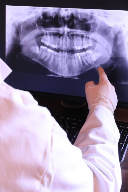 Best Emergency Gum Treatment in Yuma, CO