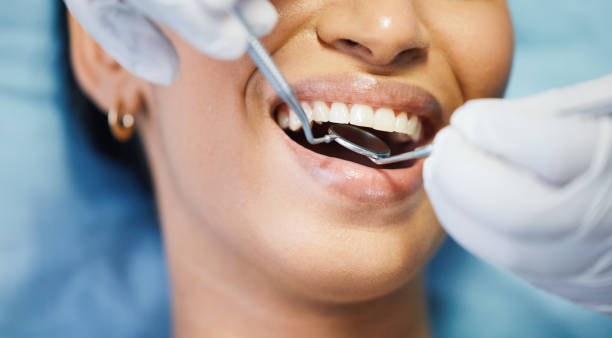 Best Cosmetic Emergency Dentistry in Yuma, CO